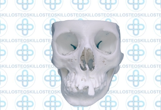 Anatomical Bone Models