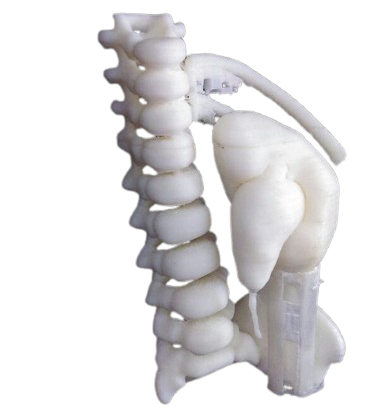 Kidney