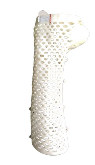 Leg Cast