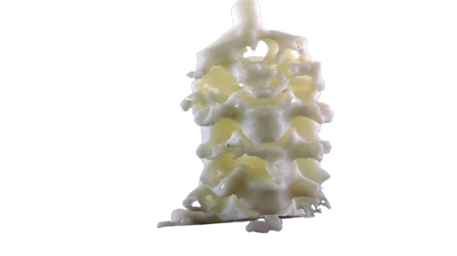 Spinal Model
