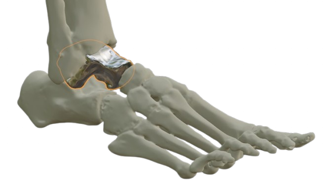 Talus